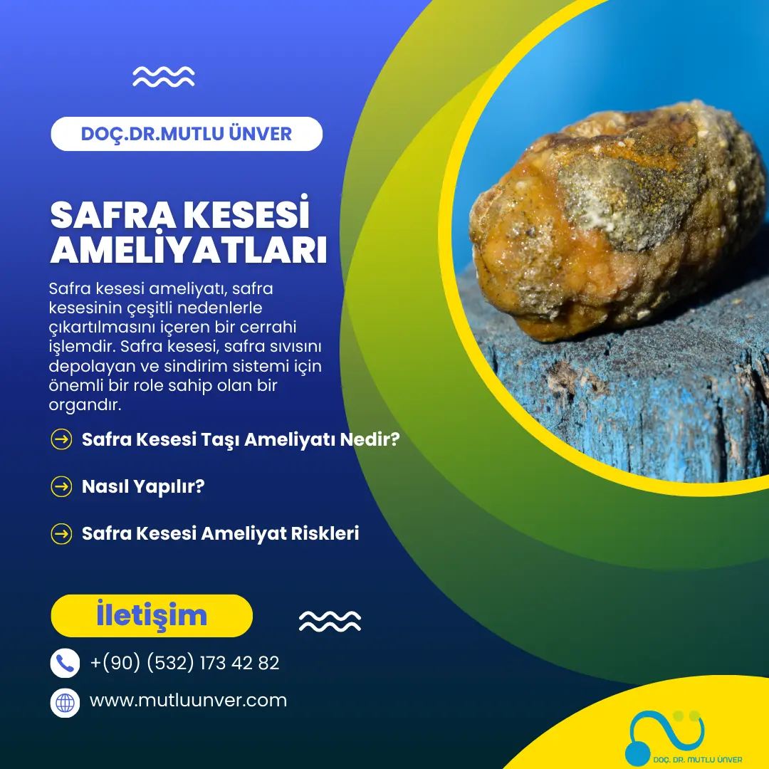safra kesesi ameliyatı