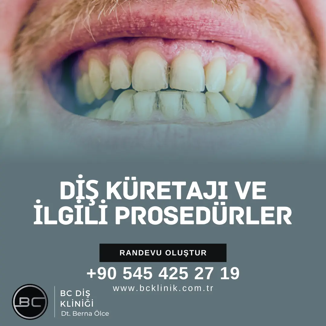 Diş taşı Temizliği sonrası oluşan boşluk geçer mi