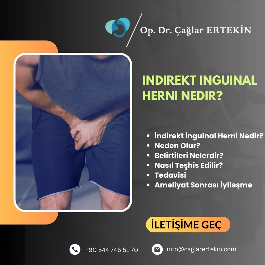 üst karın fıtığı belirtileri