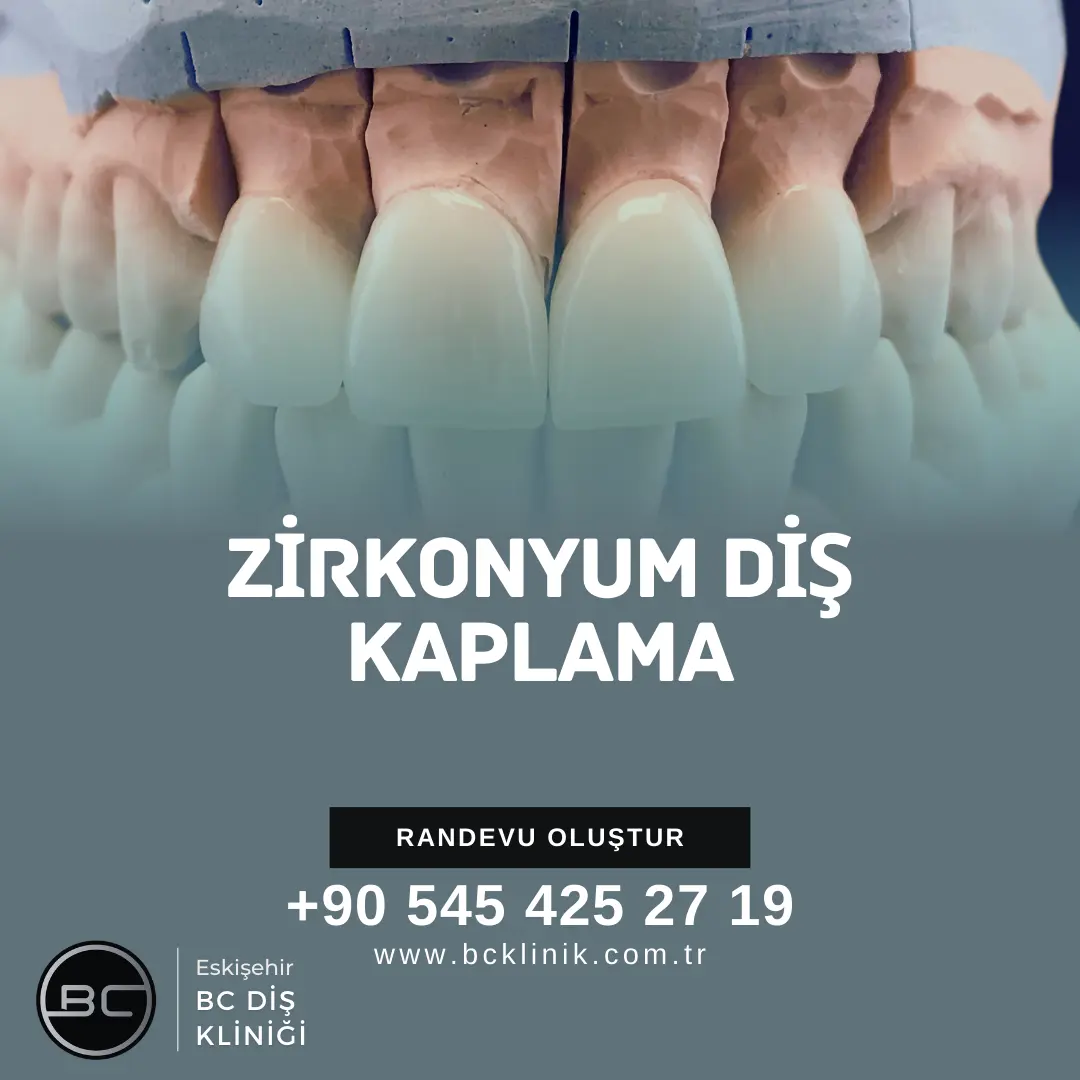 ayrık diş (diastema) tedavisi