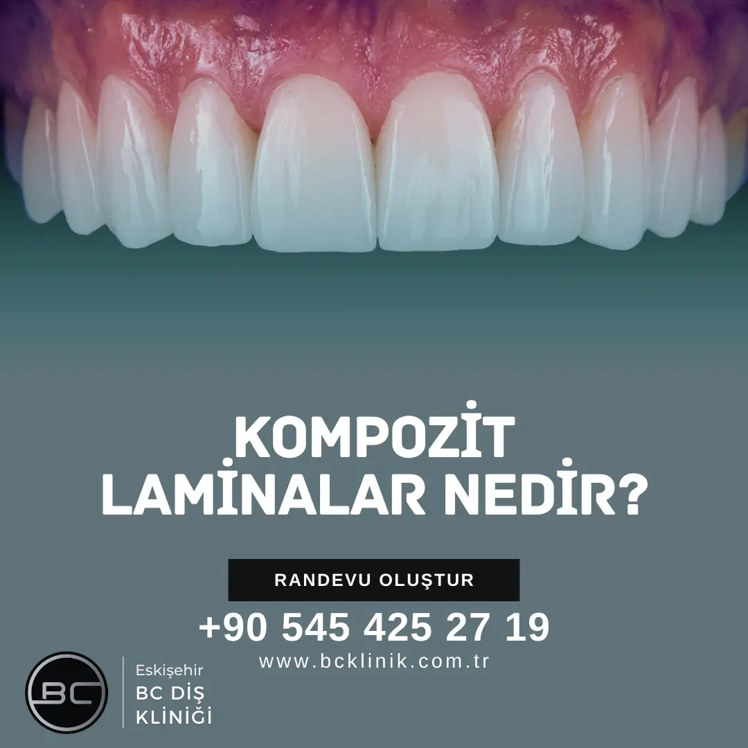 ayrık diş (diastema) tedavisi