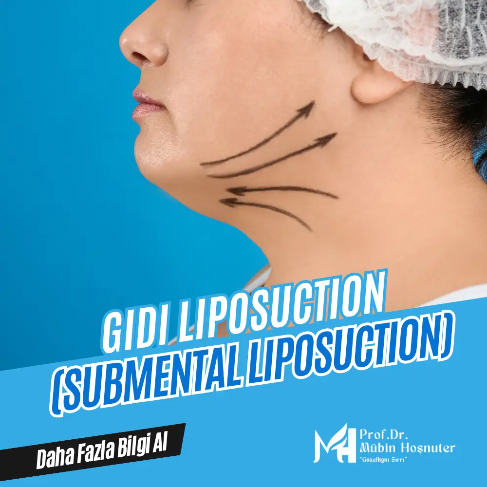 İzmir - Gıdı liposuction
