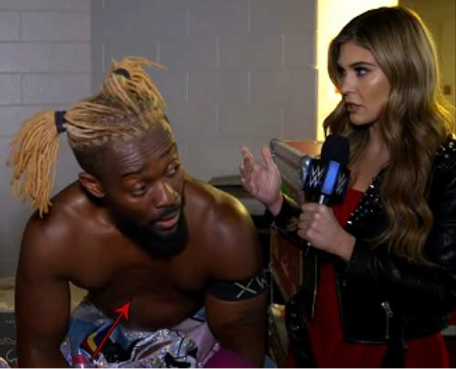 Kofi Kingston with Pectus Excavatum