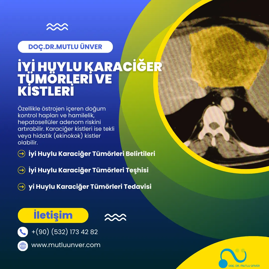 İyi Huylu Karaciğer Tümörleri ve Kistleri