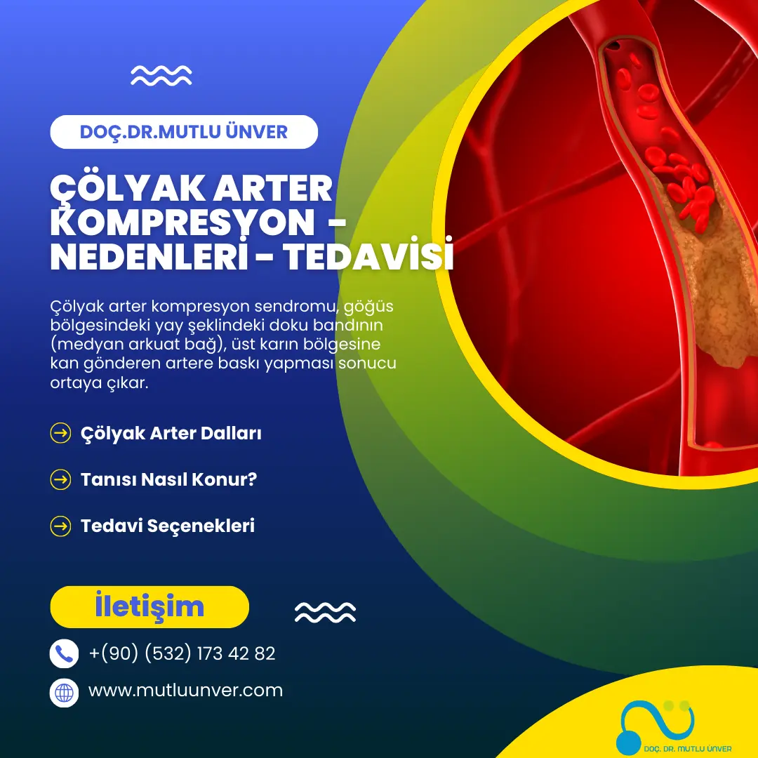 Çölyak arter Tedavisi