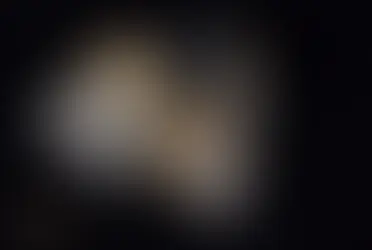 metal destekli porselen diş fiyatı