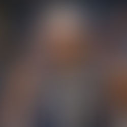 NBA: Cousins Out For the Year