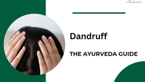 Managing Dandruff : The Ayurveda Guide