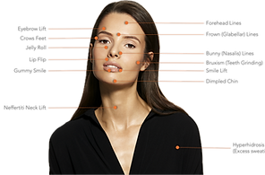 Anti-Wrinkle Options