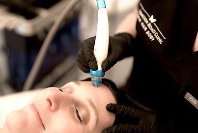 HydroFacial Close Up 3.png