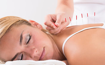 Woman lying down looking to left with needles in back