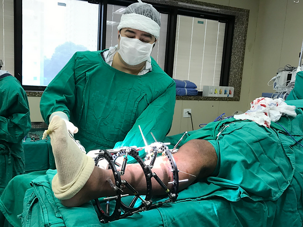 Fixação externa para correção de deformidades