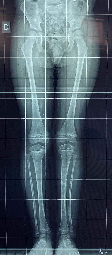 Correção comprimento e eixos