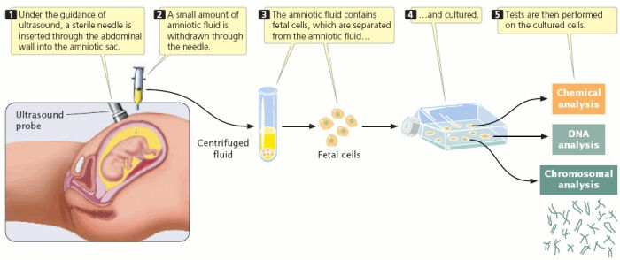 PRENATAL TESTING