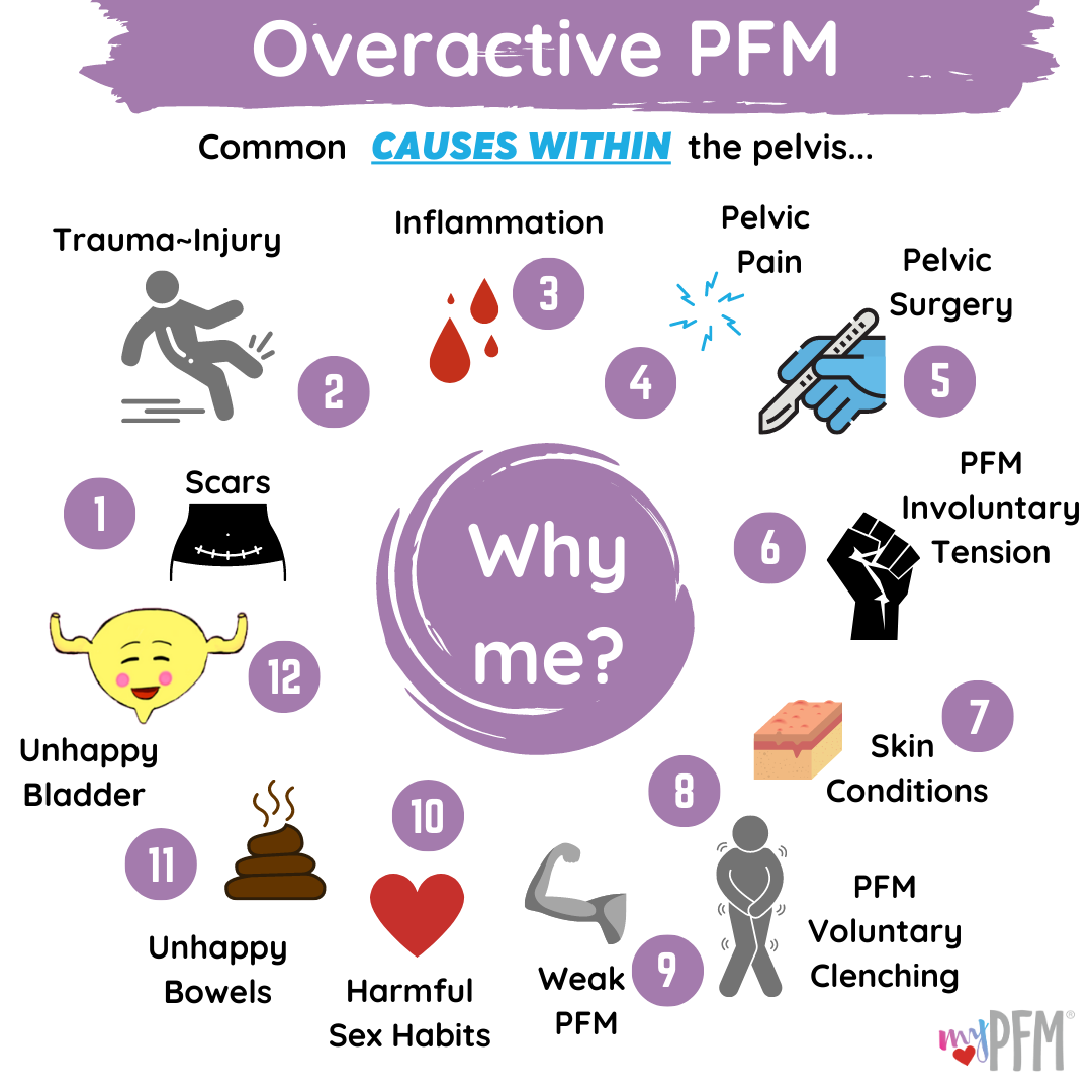 Overactive PFM
