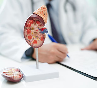 Chronic kidney disease, doctor with model for treatment urinary system, urology, Estimated