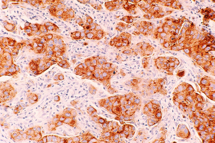 national-cancer-institute-I-F4ibaAtLA-unsplash.jpg