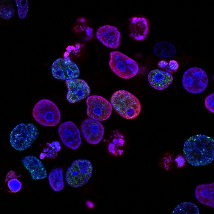national-cancer-institute-L7en7Lb-Ovc-unsplash.jpg