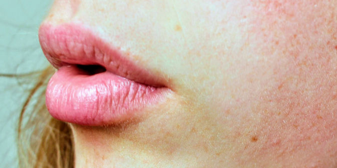 Lip Filler 101: What to Expect From Your First Appointment