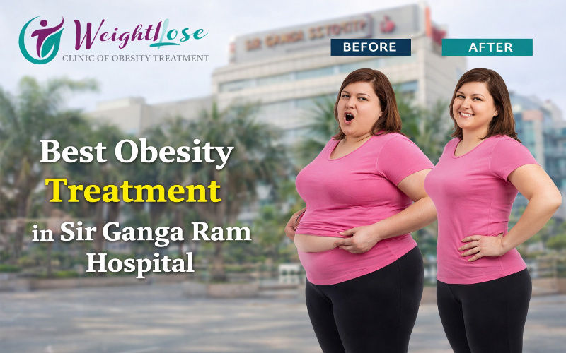 Best Obesity Treatment in Sir Ganga Ram Hospital