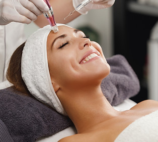 Microneedling with PRP