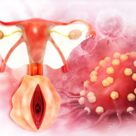 Semana Europea de la Prevención del Cáncer de Cuello Uterino