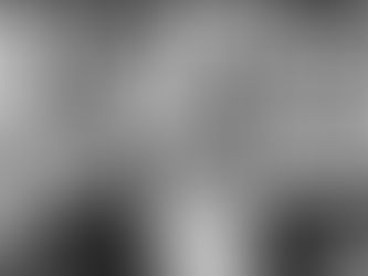 Joseph Merrick, el “hombre elefante”, que dio nombre a un síndrome