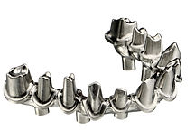 Dental Lab Dental Implants