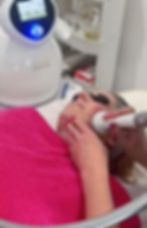 Olivia giving a RF treatment