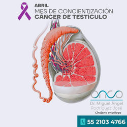 Cáncer de Testículo