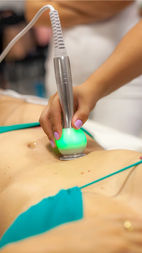 Mão segurando ponteira de radiofrequência sobre o abdomen de paciente.