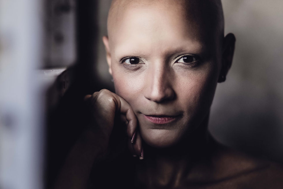 International Alopecia Day