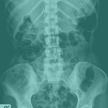 BONE HEALTH PROGRAM.png