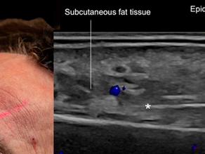 Ultrassom Dermatológico