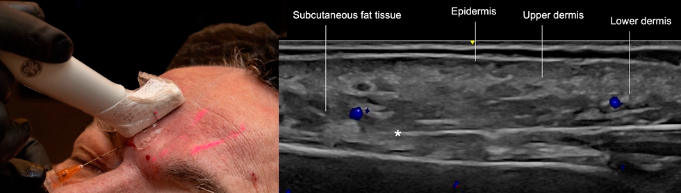 Ultrassom Alta resolução facial
