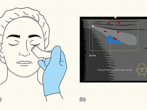 Ultrassom Facial