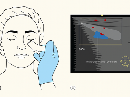 Ultrassom Facial