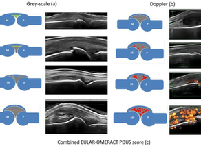 Doppler Articular