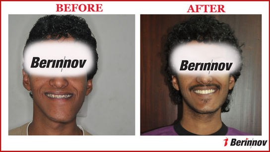 Surgical Treatment Case - 01