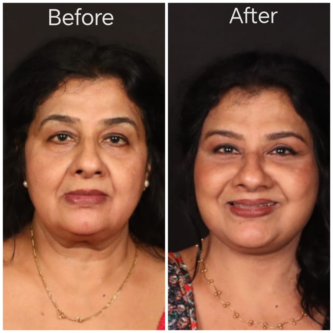 WhatsApp Image 2025-11-07 at 12.44.51 PM.jpeg