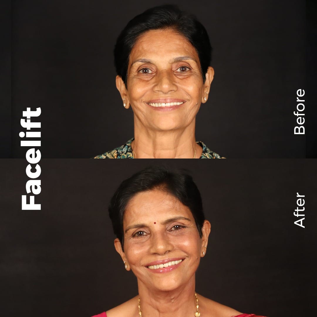 WhatsApp Image 2025-11-11 at 2.32.31 PM (1).jpeg