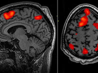 Overview of Brain Imaging Techniques