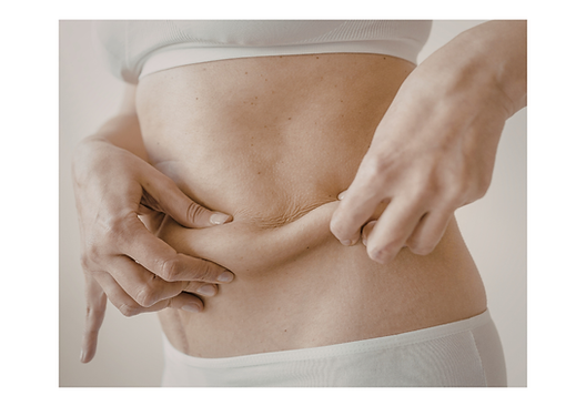 Stubborn fat and Loose Skin.png
