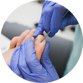 Ingrown Toenail Surgery