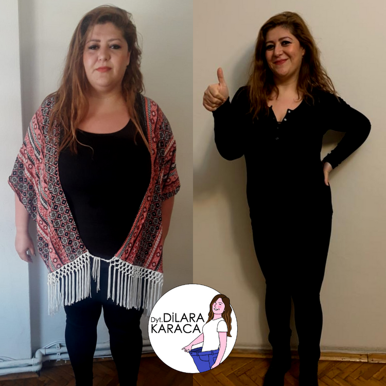 Before After Dilara Karaca Www 60kiloverendiyetisyen Com