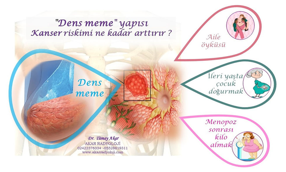 dens meme yapısı riski