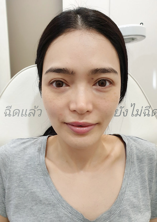 BeautyPlusMe_20190305225425_save-01.jpeg