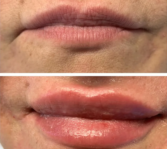 bb lips 1