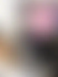 Alertan sobre la prevalencia del glaucoma en La Romana: el 50% de los afectados desconoce su condición