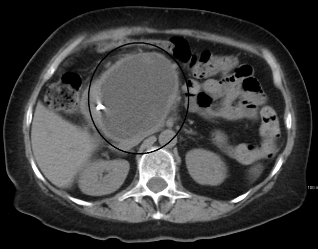 What Is the Role of RIS Imaging Software in Medical Technology?